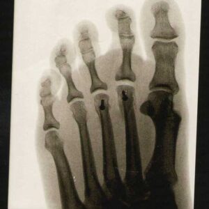 Your Mind Can be a Pain in the Butt Image